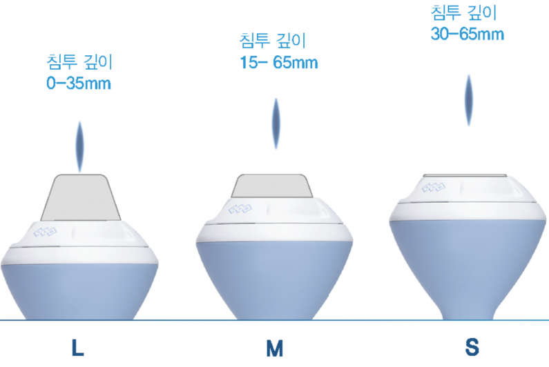 체외충격파